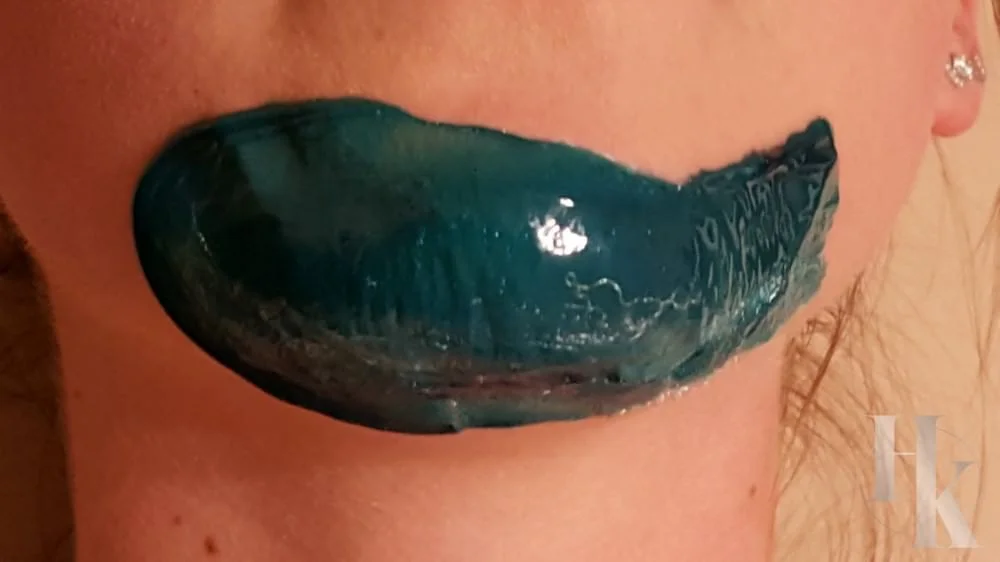 Chin image