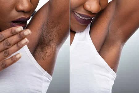 Under Arm image